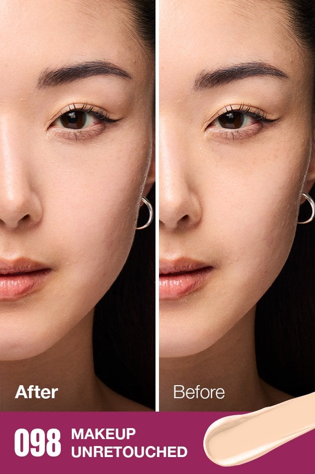 IARConcealer US BeforeAfter 095 632x950