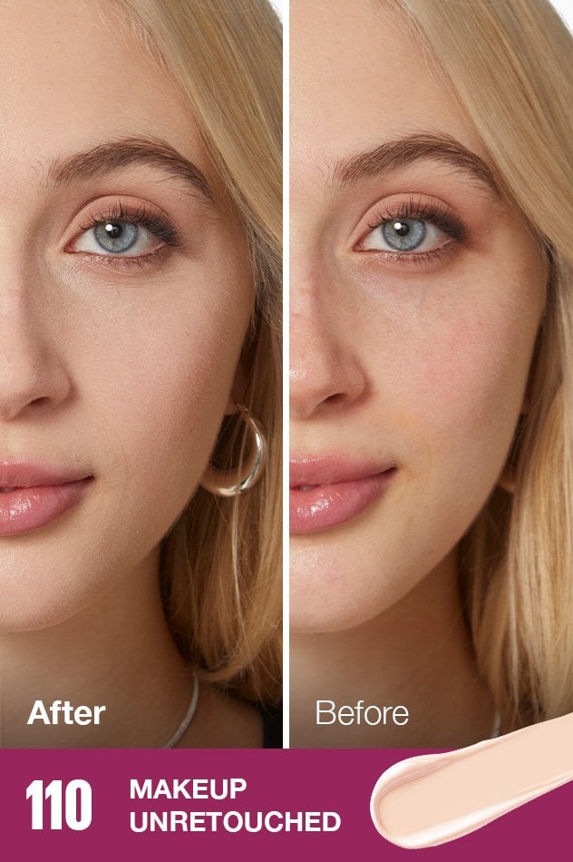 IARConcealer US BeforeAfter 110 632x950