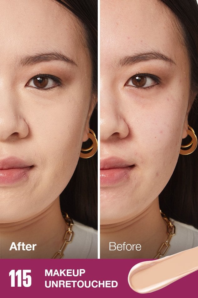 IARConcealer US BeforeAfter 115 632x950