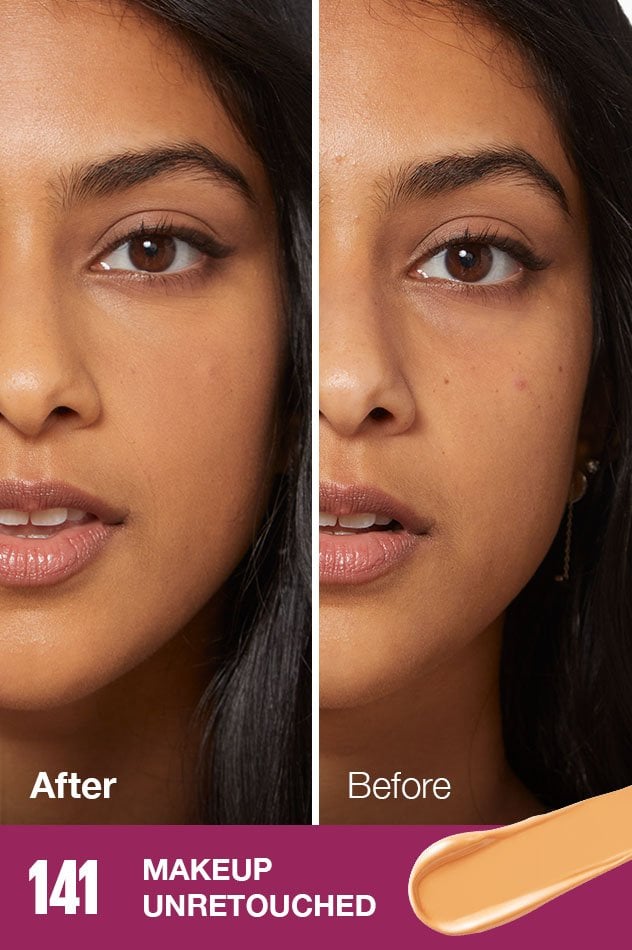 IARConcealer US BeforeAfter 141 632x950