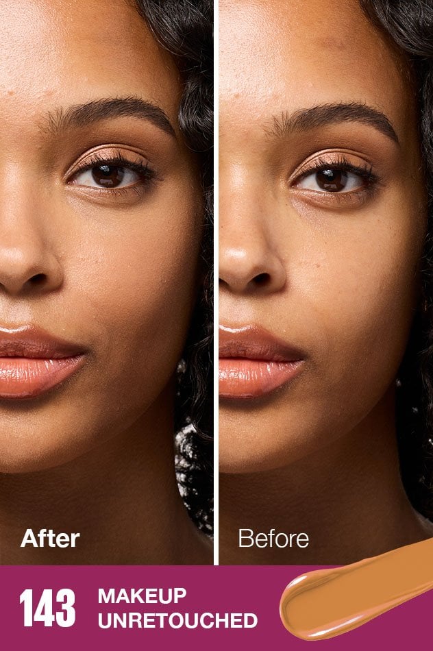 IARConcealer US BeforeAfter 095 632x950