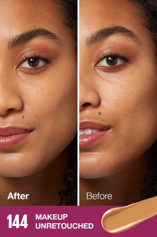 IARConcealer US BeforeAfter 144 632x950