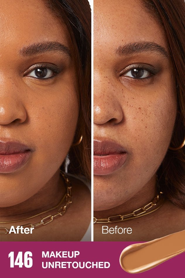 IARConcealer US BeforeAfter 146 632x950