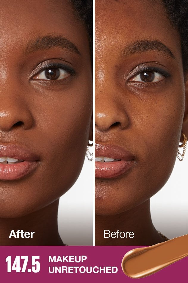 IARConcealer US BeforeAfter 1475 632x950