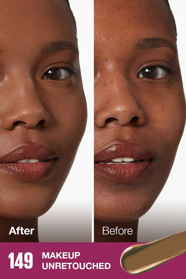 IARConcealer US BeforeAfter 149 632x950