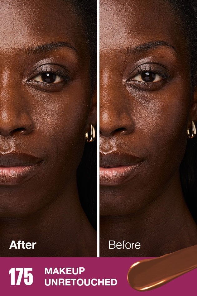 IARConcealer US BeforeAfter 095 632x950