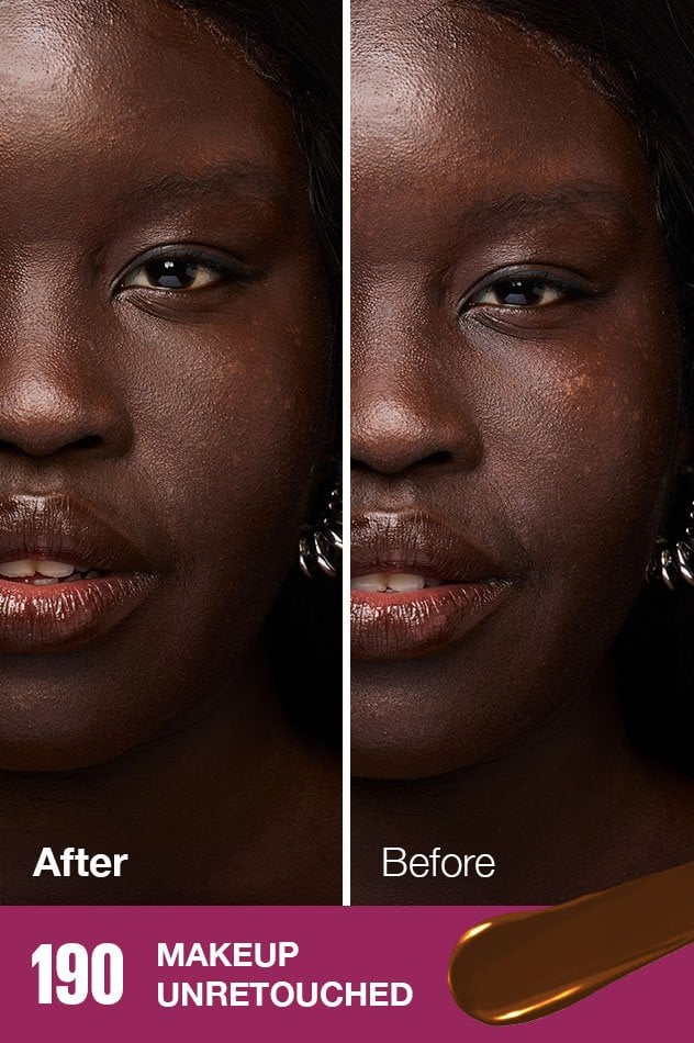 IARConcealer US BeforeAfter 095 632x950